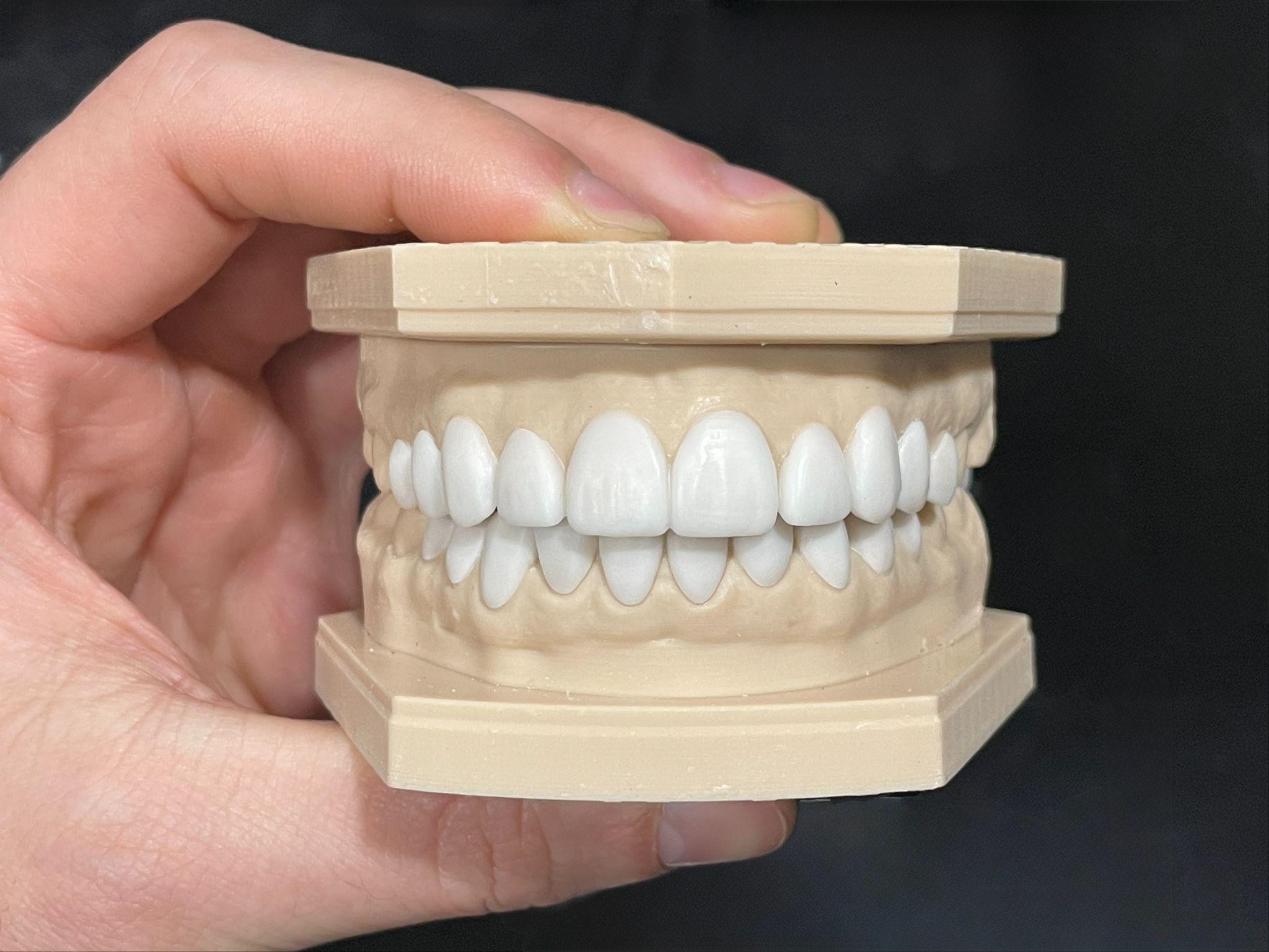 Cosmetic dentistry Coral Springs payment options comparison showing financing tiers