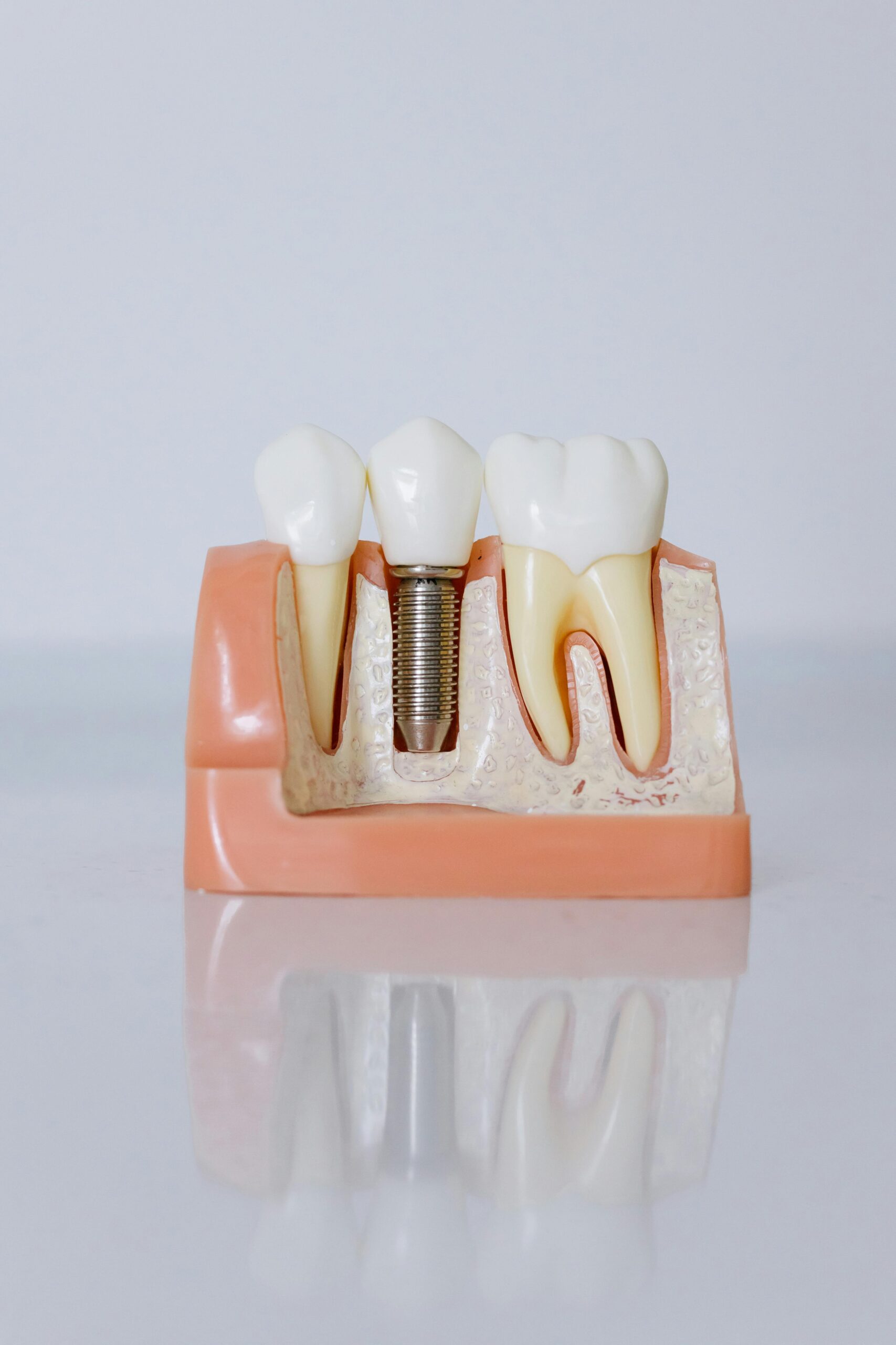 invisalign provider Parkland FL